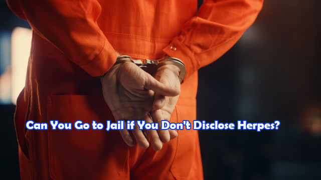 Can You Go to Jail if You Don't Disclose Herpes?
