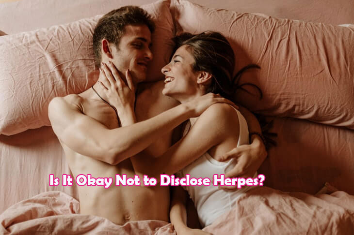 Is It Okay Not to Disclose Herpes?
